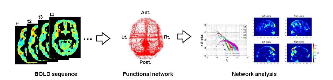 fMRI BOLD 신호로부터 네트워크 추출 및 분석 모식도