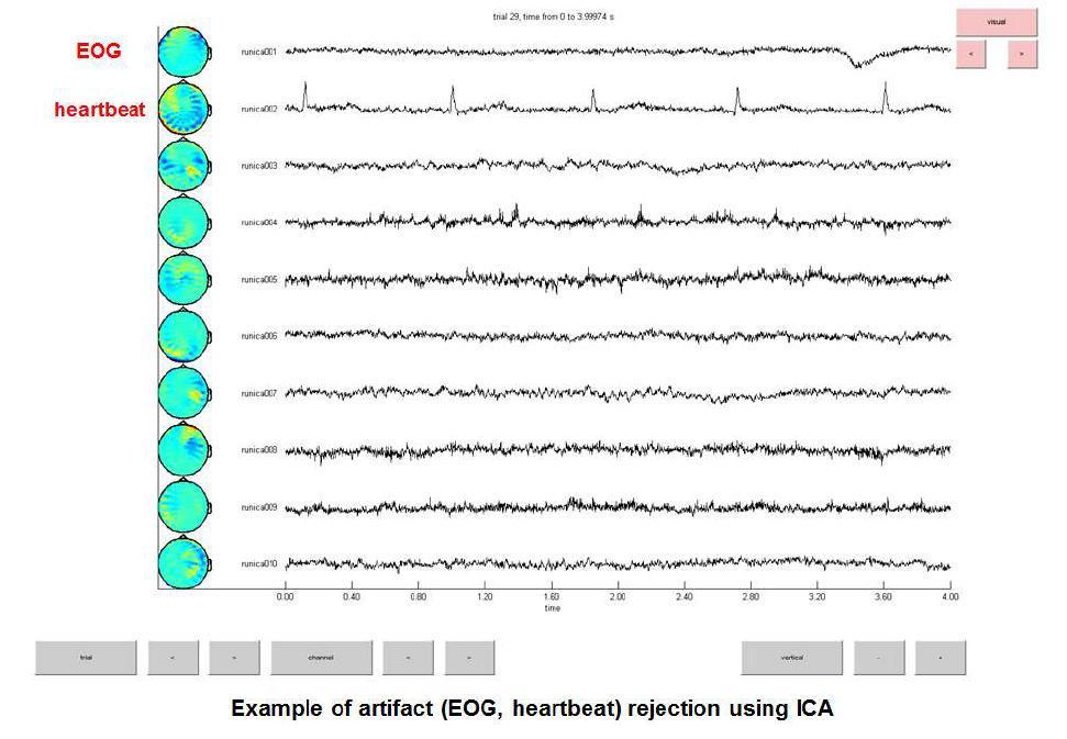 독립성분분석(ICA)를 이용한 EOG, heartbeat 잡음 제거의 예