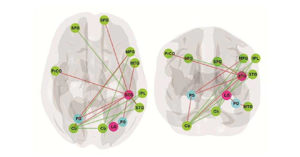 Cross-frequency power correlation in working memory (Park et al., 2011. Brain Connectivity)