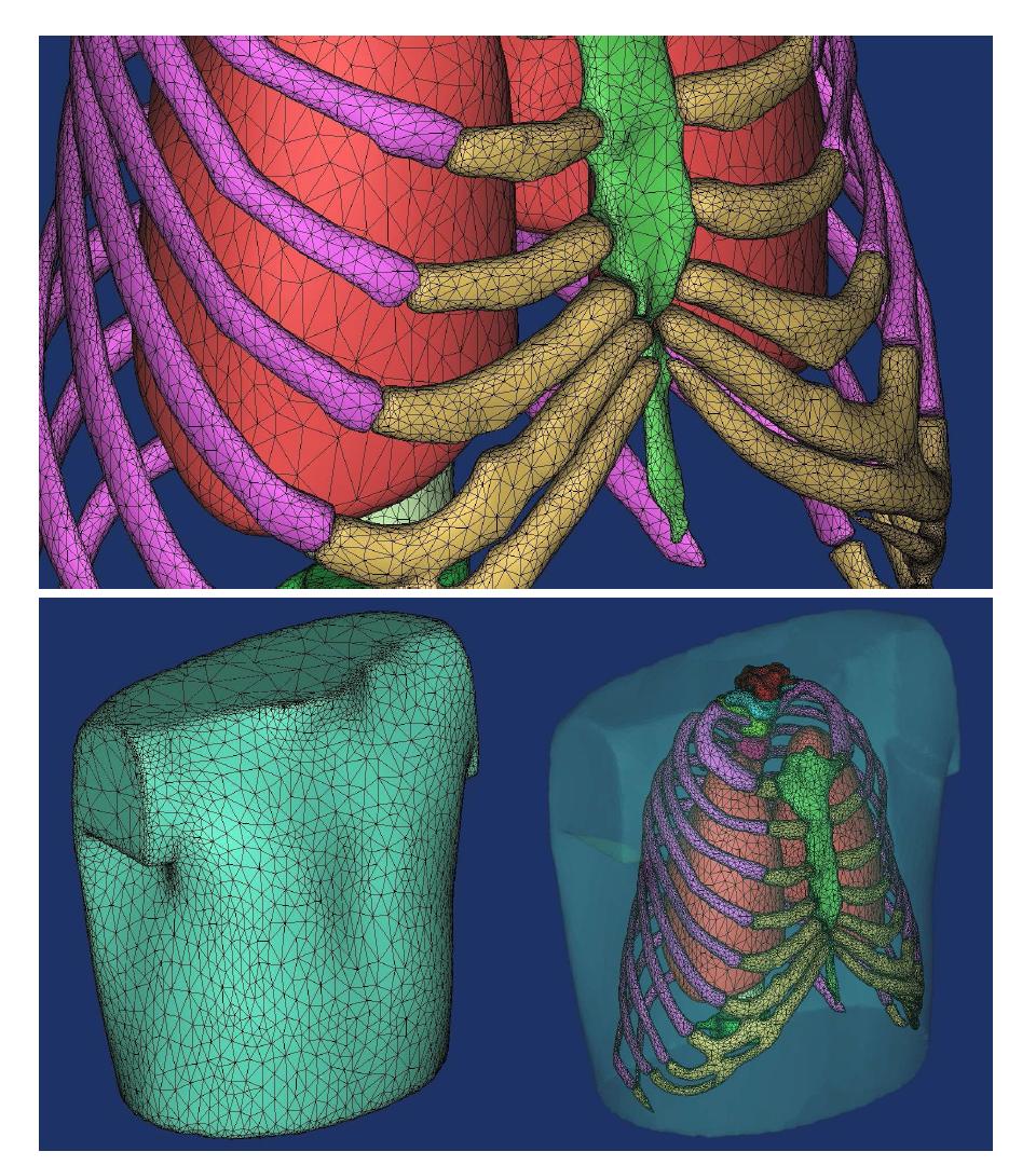 Finite element model of the digital bone model