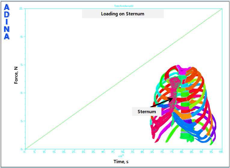 Loading on sternum