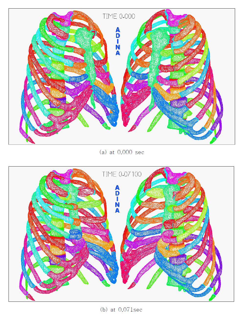 Deformation of FE Model