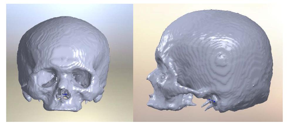 The skull model providing Digital Korean Co