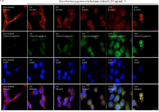 세포 내 위치하는 cleaved caspase 3의 발현 분석