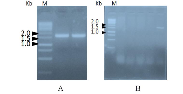 PCR 결과