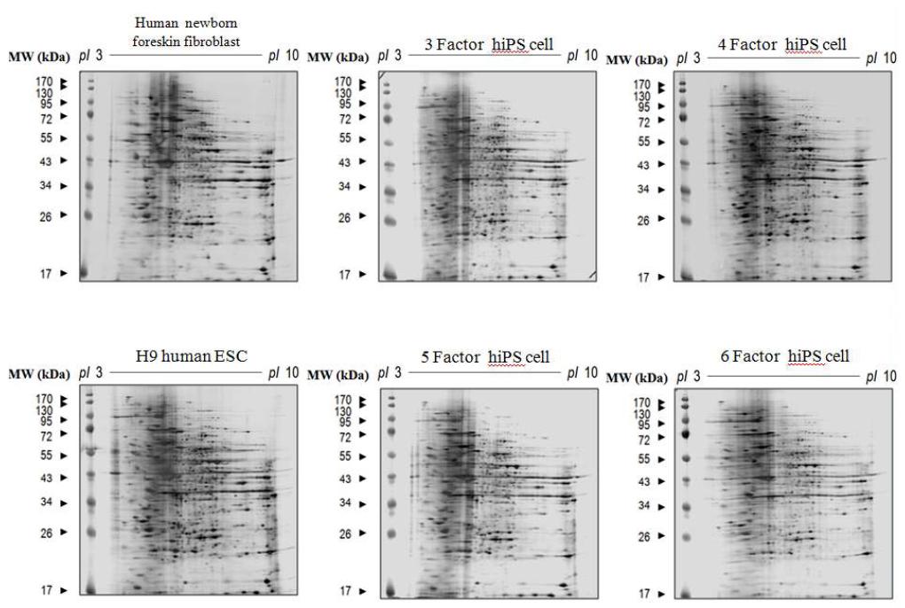 성체세포, 다양한 역분화줄기세포, 배아줄기세포주간의 대표적 2-DE 이미지