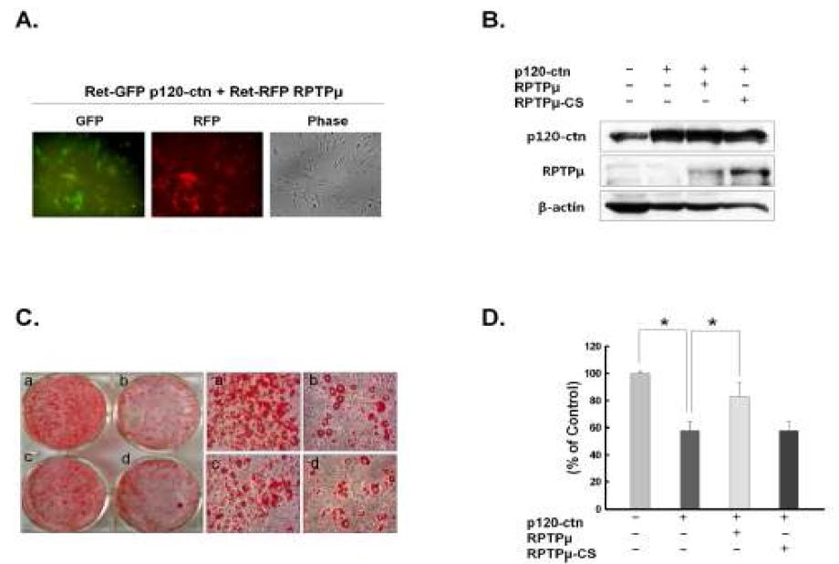 p120을 통한 RPTPμ의 지방세포 분화 관여 규명