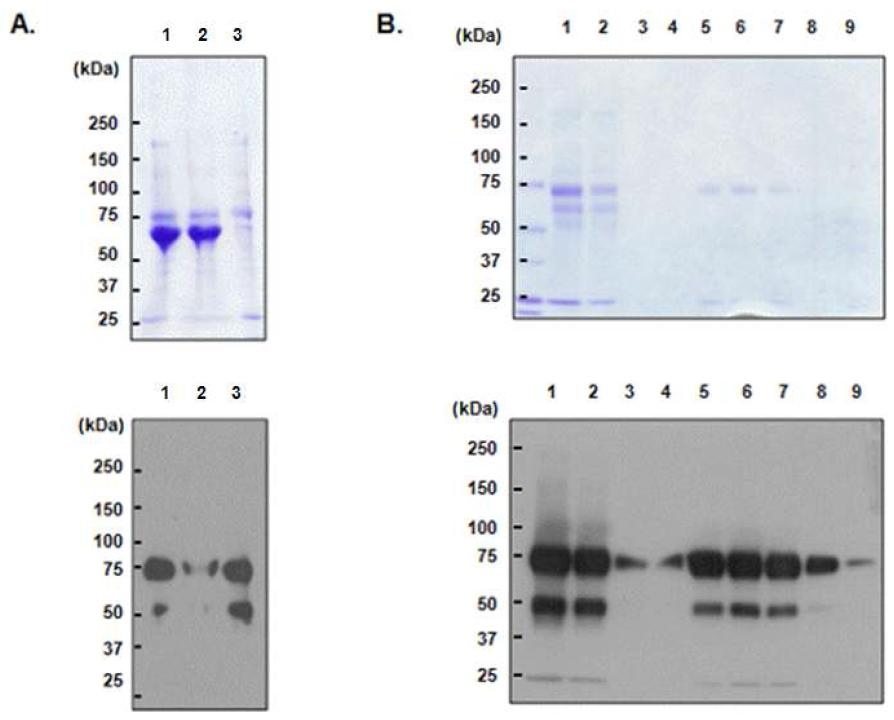 배양액의 Ammnoium sulfate 침전(A) 및 ptorein L 정제(B)