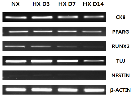 hypoxia culture condition에서 배양된 MSCs에서의 lineage-specific genes의 발현 양상