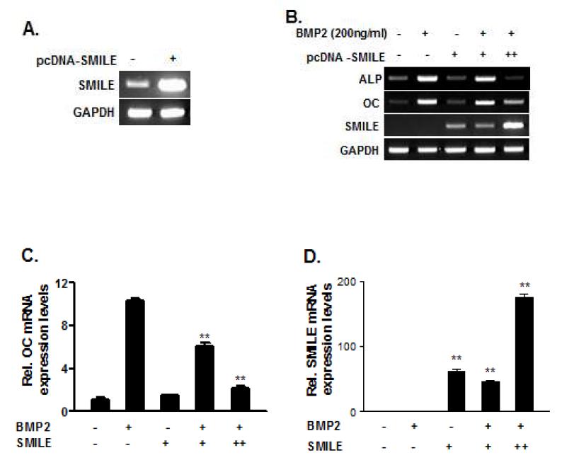 SMILE 과발현에 의한 BMP2 유도 osteogenic gene expression 억제