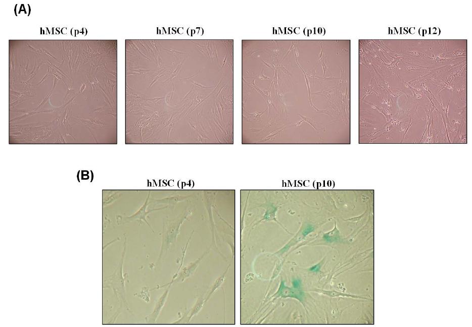 hMSC의 세포 노화에 따른 형태 변화와 SA-β-gal 활성 분석