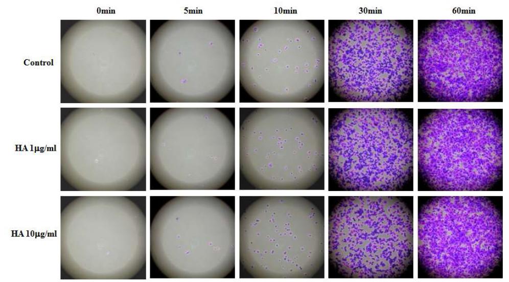 Hyaluronan 처리와 cell adhesion assay