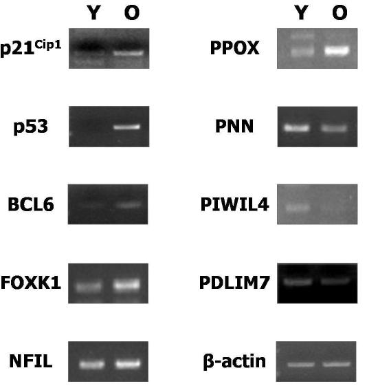 Rat muscle에서 mRNA level