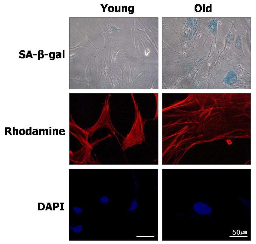 Young HDF와 old HDF의 SA-beta-gal staining과 rhodamine phalloidin staining
