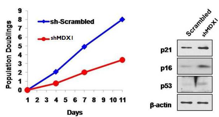 MDX1 유전자의 발현 감소에 의한 세포 증식률 감소