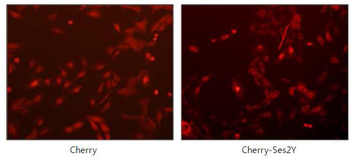Ses2Y는 C2C12 세포의 세포질에 발현된다.