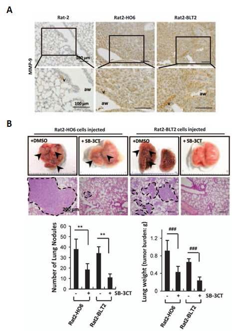 BLT2에 의한 MMP-9의 조절 기전에 의해 암의 전이 능력 향상