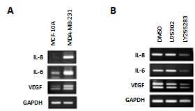 BLT2에 의한 유방암의 침윤 관련 cytokine 생성 조절