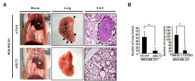 동물 모델을 이용하여 BLT2에 의한 유방암의 침윤성 조절 능력 증명