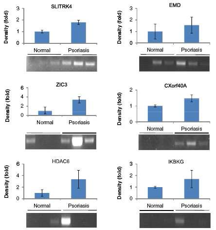 과메틸화된 유전자 methylation 정도 확인