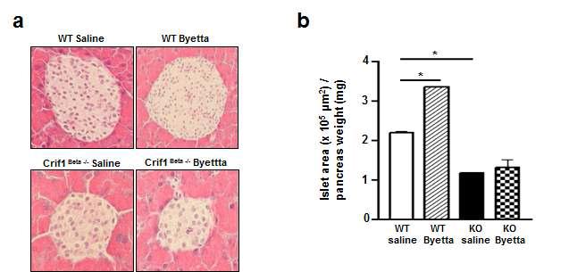 췌장 beta dell 특이적 결손 마우스에 GLP-1 agonist byetta 4주투여후islet area 변화 관찰 및 분석