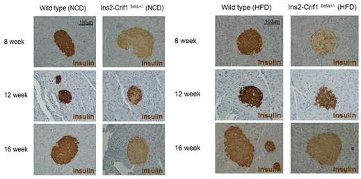 고지방 식이 및 일반식이에 따른 주차별 insulin content변화