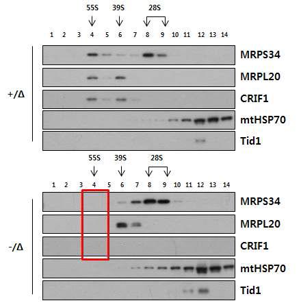 CRIF1 결손세포의 미토콘드리아 리보좀 분석