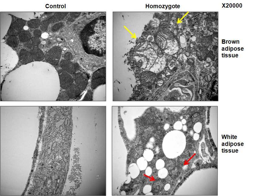 Adipose tissue 특이적 CRIF1 knock out 마우스의 지방 조직 내 미토콘드리아