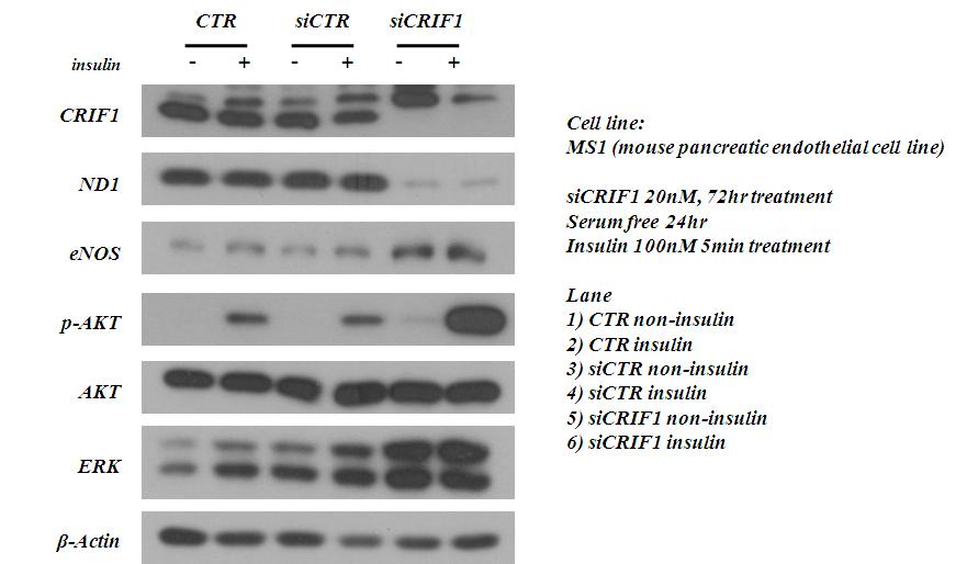 CRIF1 유전자 소실에 따른 미토콘드리아와 내피세포기능 이상