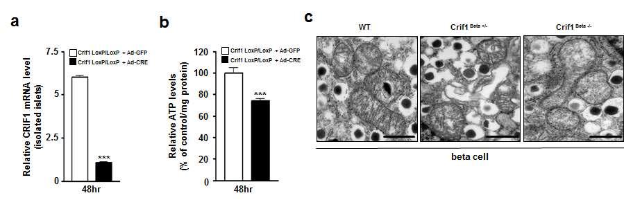 췌장 베타세포 특이적 CRIF1 결손마우스의 미토콘드리아의 표현형 및 기능분석