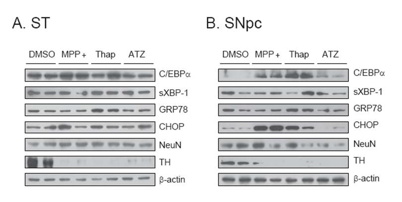 Identification of the candidate proteins involved in ER/mitochondrial stress-induced neurodegeneration.