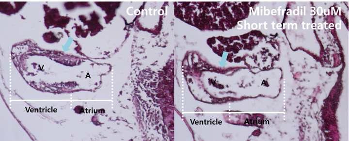 T-형 칼슘 통로 저해제 처리시 발생중인 Xenopus 배아 심장의 조직학적 차이