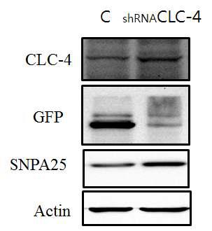 CLC-4 shRNA expression in the hippocampus.