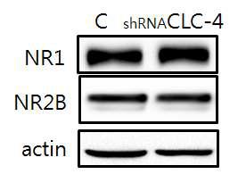 NR1 and NR2B expression in the CLC-4 knock-down hippocampus.