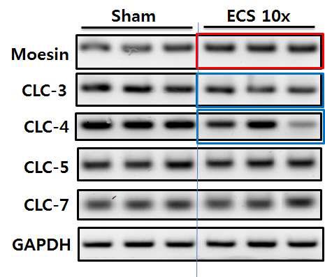 CLC-4 expression after electroconvulsive shock in the rat.