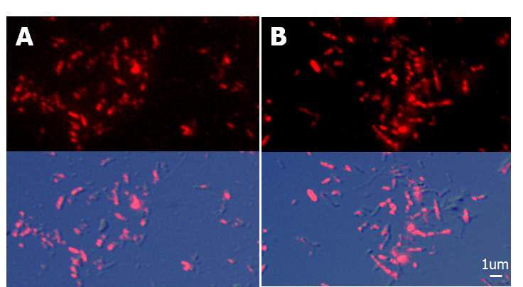 액체 배지로의균 고(B세)의균 I접m종mu n1o4f일lu o후re s성ce장nc한e 수균행(A 후)과 형 고광체 현 배미지경로 사의진 고세균 접종 7일 후 성장한 균(B)의 Immunofluorescence 수행 후 형광 현미경 사진