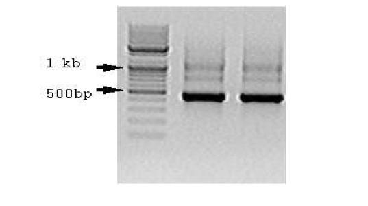 혐기 슬러지에서 추출한 DNA를 PCR로 증폭시킨 산물