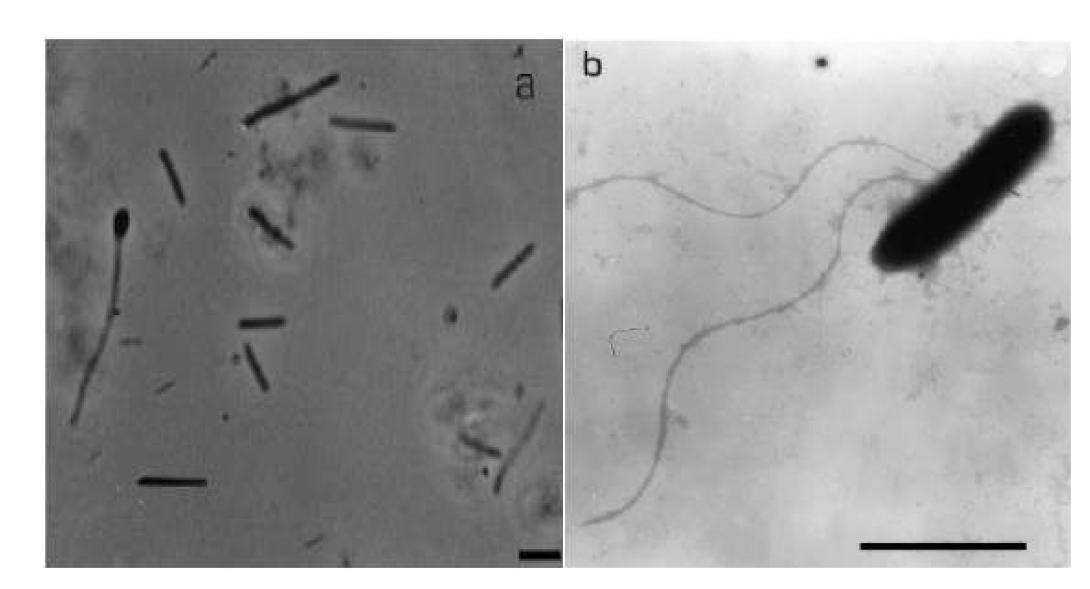 Sporanaerobacter acetigenes 의 사진 (왼쪽 지표: 5 um, 오른쪽 지표: 2 um)