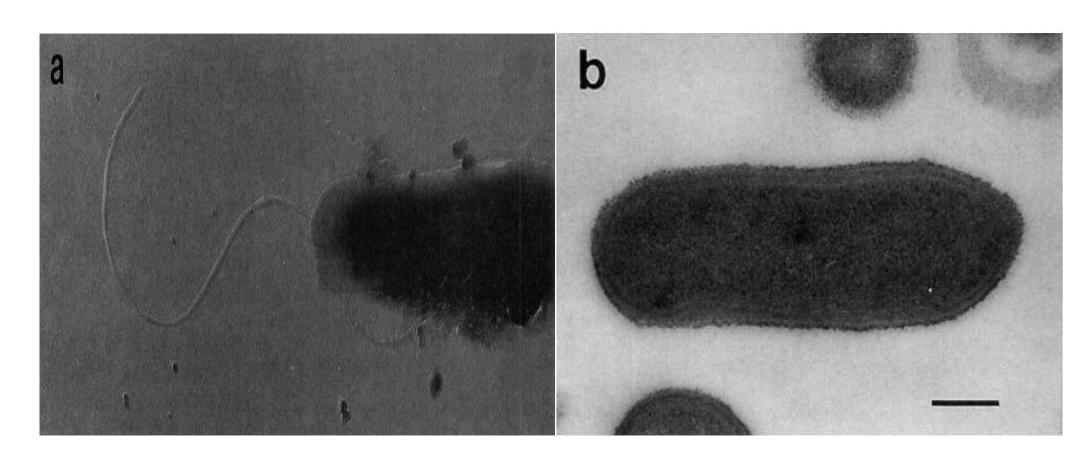 Clostridium ultunense 의 사진 (오른쪽 지표: 0.23 um)