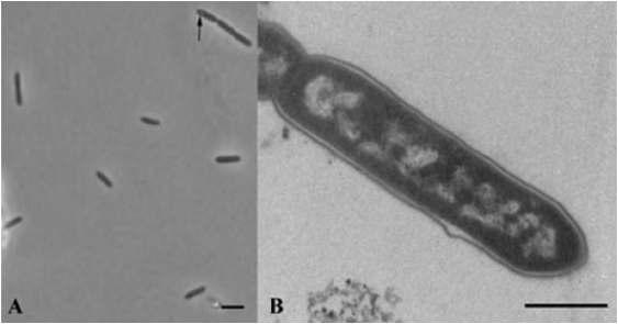 Alkaliphilus oremlandii 의 사진 (왼쪽 지표: 2 um, 오른쪽 지표: 0.5 um)