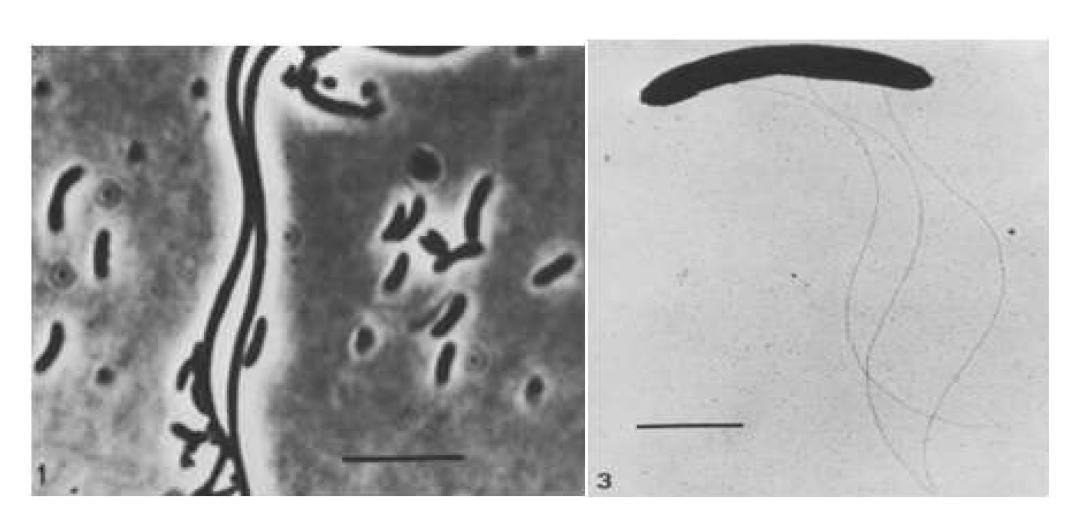 Syntrophomonas sapovorans 의 사진 (왼쪽 지표: 5 um, 오른쪽 지표: 1 um)