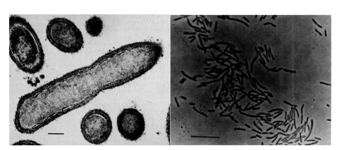 Coprothermobacter proteolyticus 사진(왼쪽 지표: 0.2 um, 오른쪽 지표: 10 um)