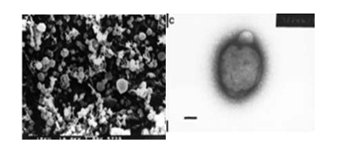 Methanosarcina mazei 사진 (왼쪽 지표: 1 um, 오른쪽 지표: 0.1 um)