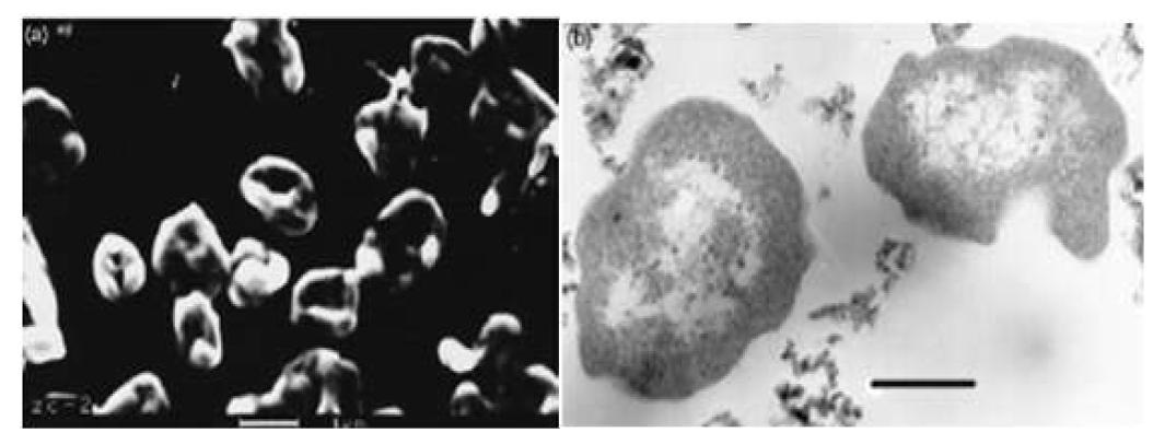 Methanoculleus receptaculi 사진 (왼쪽 지표: 1 um, 오른쪽 지표: 0.5 um)