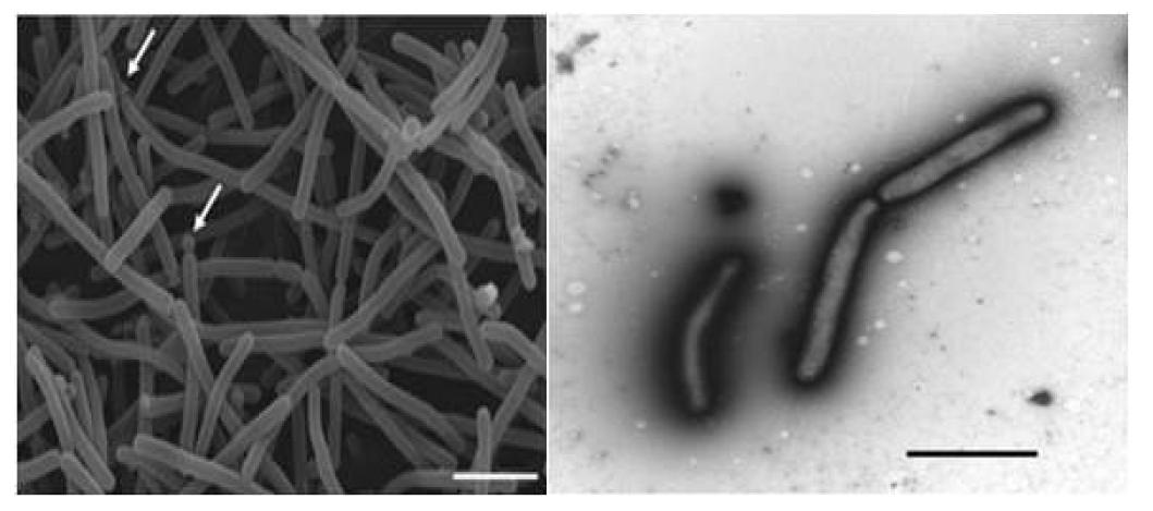 Methanothermobacter crinale 사진 (왼쪽 지표: 1 um, 오른쪽 지표: 0.5 um)