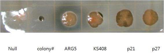 알긴산 0.2%가 도포된 LB/Agar plate에서 보여주는 E.coli BL21 발현 양상. .