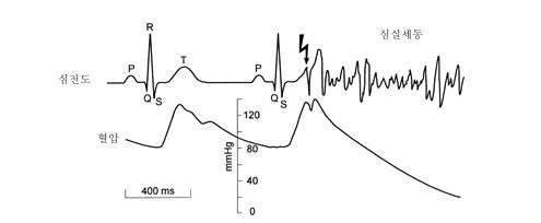 취약기에서 심실세동한계-심전도와 혈압에 대한 영향