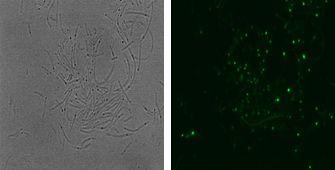 poxB-gfp융합 유전자가 도입된 대장균에 대한 광학현미경 및 형광현미경 사진.