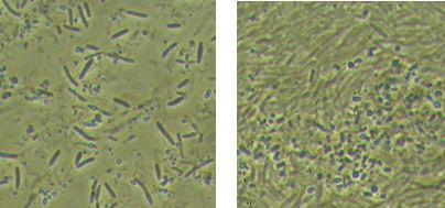 대장균에서 PoxB-Gal1및 PoxB-chitinasefusionprotein이 과발현되어 인클루젼바디를 형성한 현미경 사진.