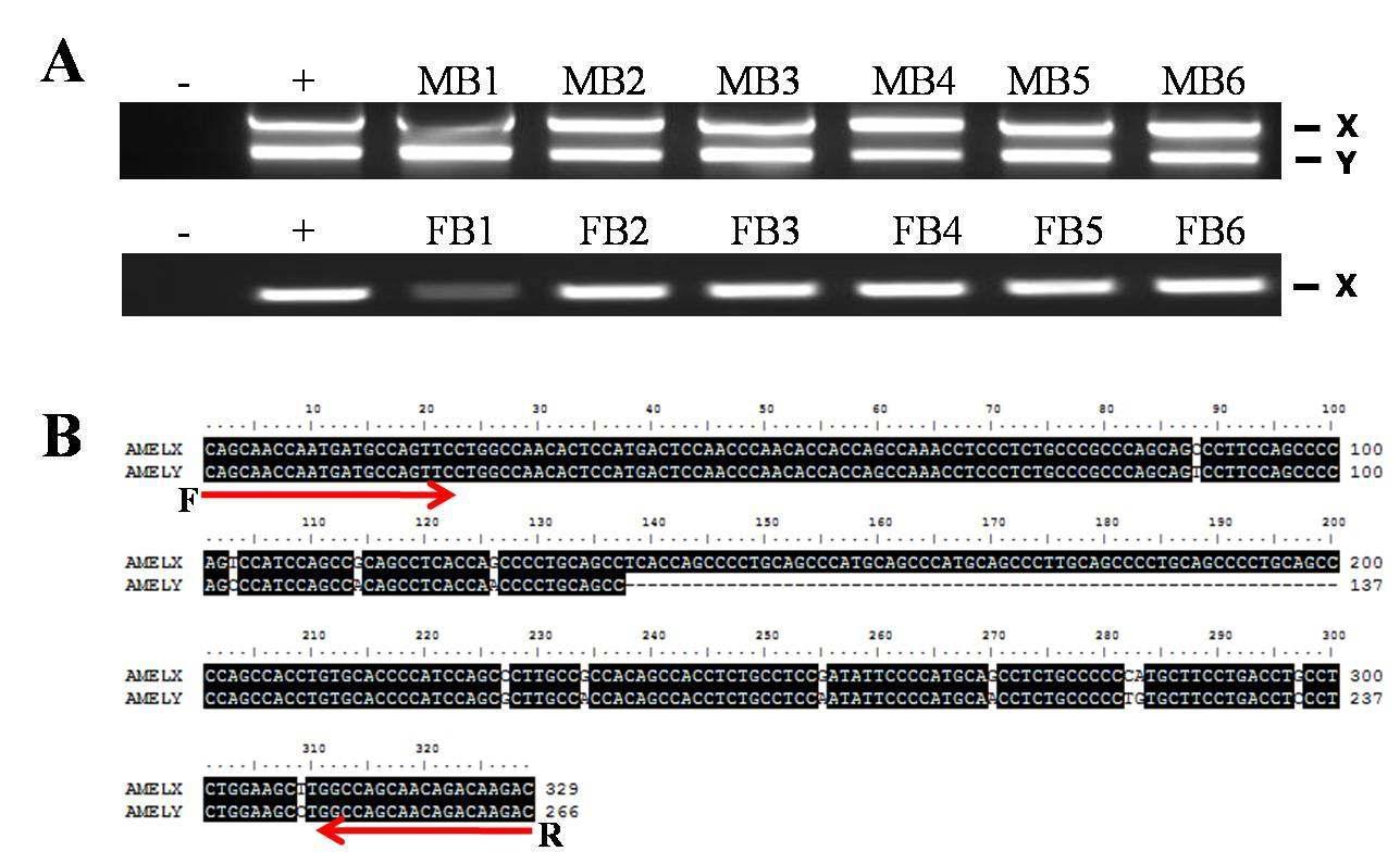 Representative amelogenin PCR product from genomic DNA of male-blastocyst candidates (MB1~MB6) or female-blastocyst candidates (FB1~FB6).